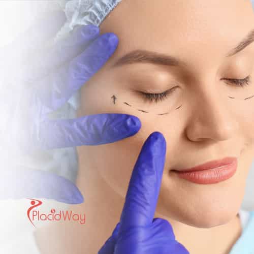 How to Get a Facelift in Mexico City, Mexico: A Step-by-Step Guide for New Yorkers